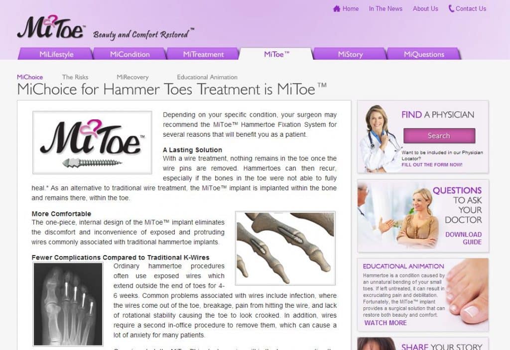 Hammer-toe-treatment