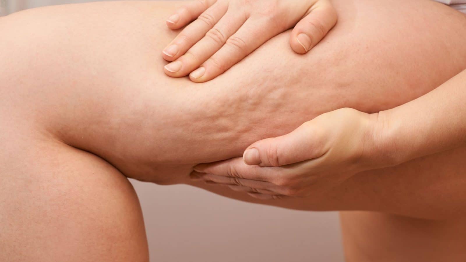 Cellulite Treatments